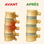 VertAlya™ — Soulagez la Sténose Spinale & le Mal de Dos Sans Opération | 15 Minutes par Jour